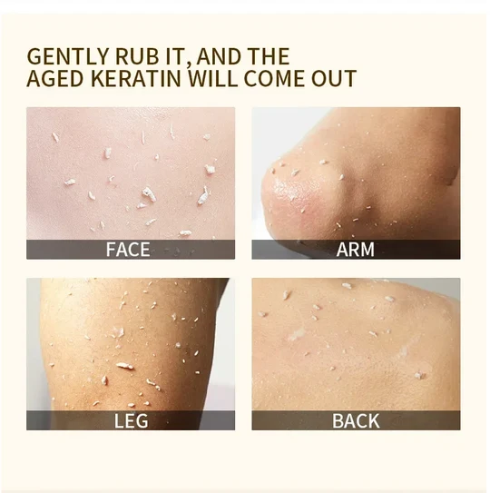 🍊 Tidsbegrænset tilbud: 1+1 gratis! Appelsin eksfolierende gel – fjerner blidt døde hudceller ✨