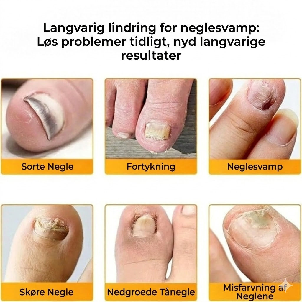 FungalPatch – Kraftigt negleplejesæt – Selvklæbende svampedræbende plaster